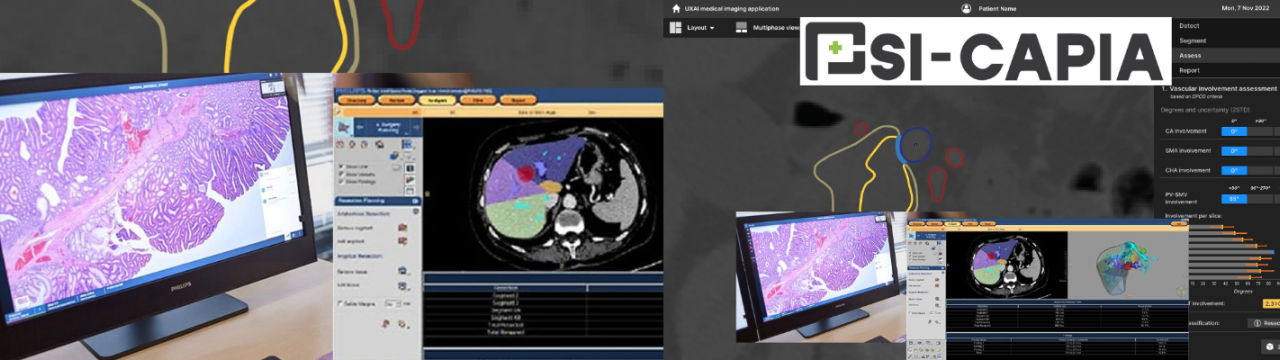 Prototyping Seamless Interactive Clinical workflows for Advanced radiology & Pathology Image viewing & AI