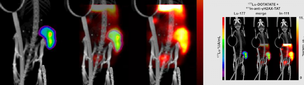 Quantitative SPECT imaging of theranostics: radionuclide imaging and quantification for therapy and in vivo biodosimetry