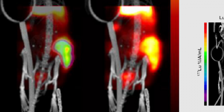 Quantitative SPECT imaging of theranostics: radionuclide imaging and quantification for therapy and in vivo biodosimetry