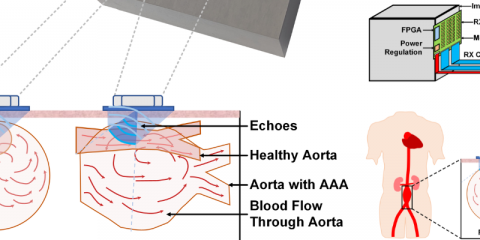 Ultrafast Ultrasound Probe for Improved Diagnosis of Vascular Disease