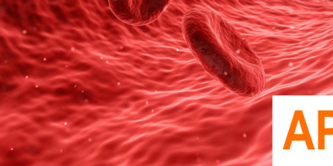 AI-guided Precision Operation for LocaLization and Optimization