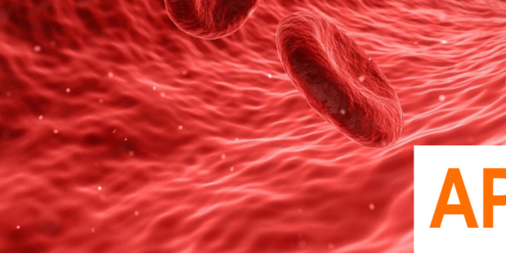 AI-guided Precision Operation for LocaLization and Optimization