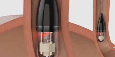 Immuno-OCT Capsule Camera